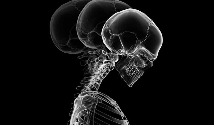 ustawienie zagłówka